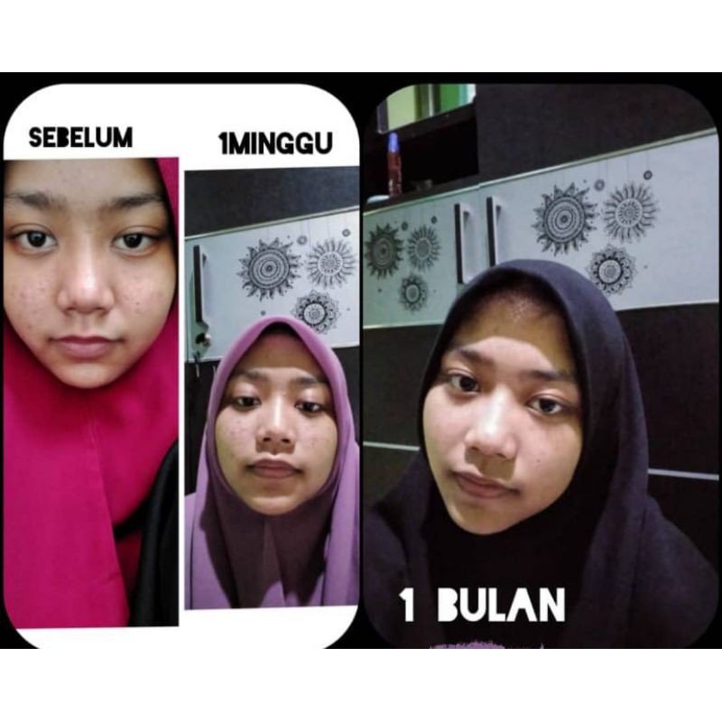 paket ultimate NBS skincer