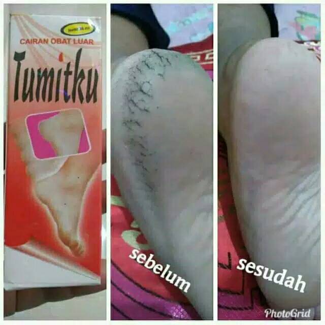 Tumitku
