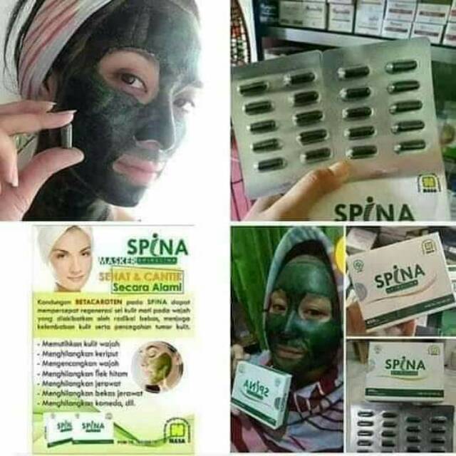 Spina nasa