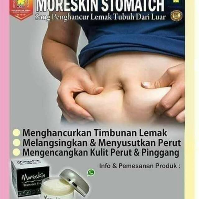 Susut perut