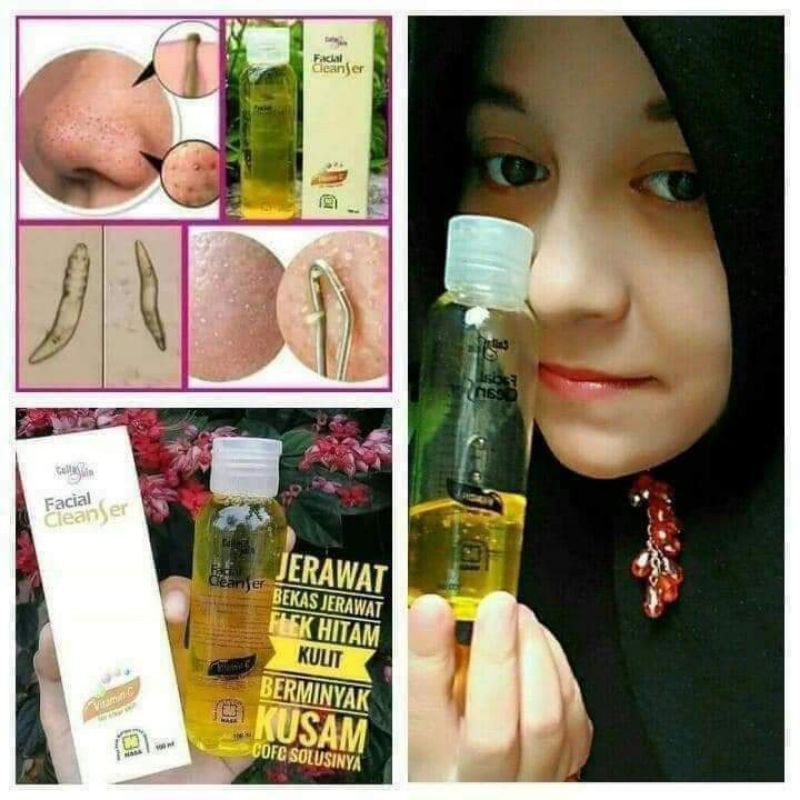 pengangkat komedo
