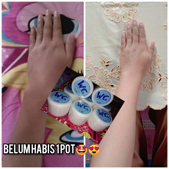 WG LOTION