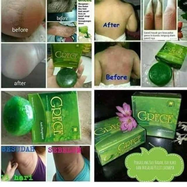 Obat gatal NASA