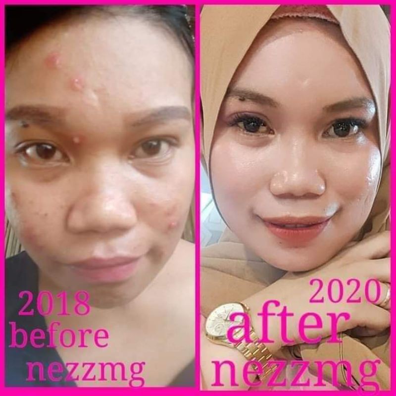 Nezzmg