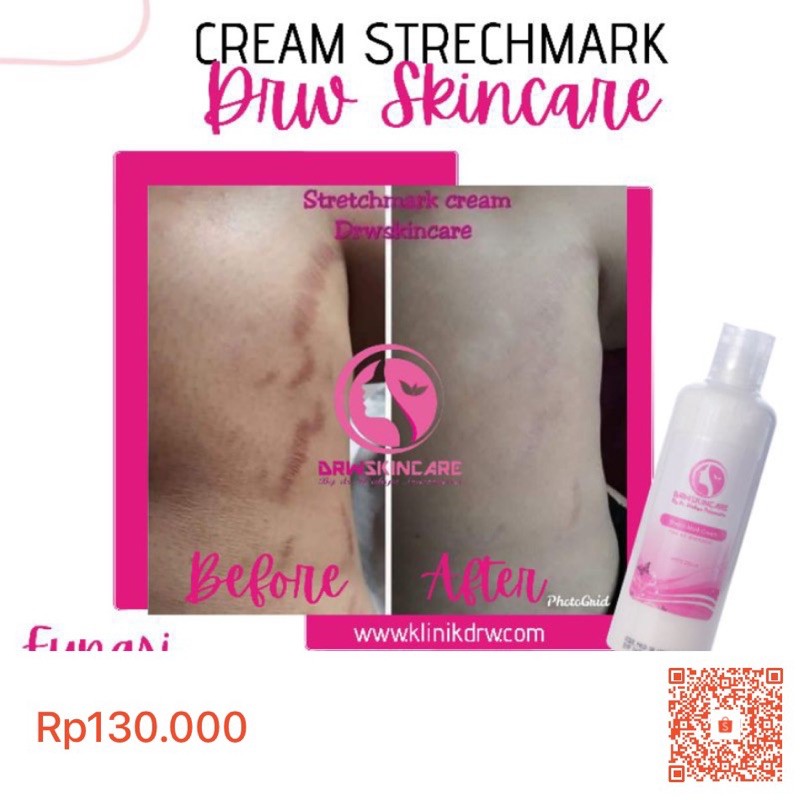 Stretch Mark Cream DRW