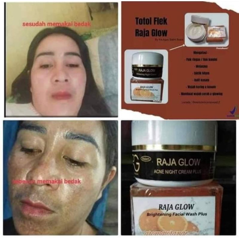totol flek rajaglow