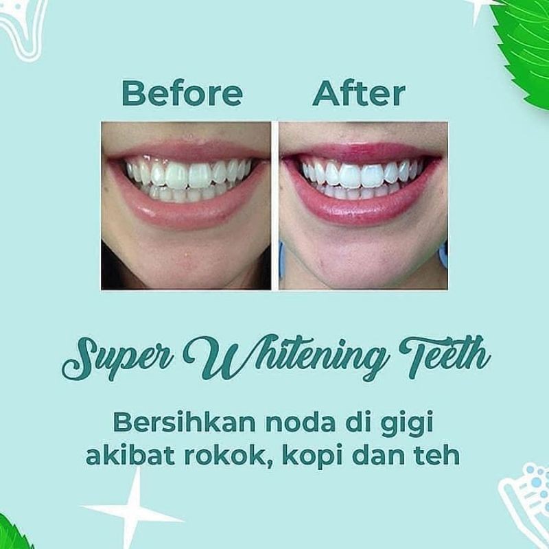 Perawatan dan Pemutih gigi