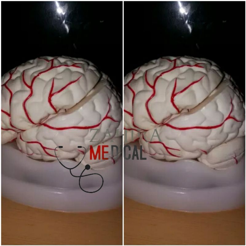 PHANTOM MANIKIN/MANEKIN MODEL OTAK