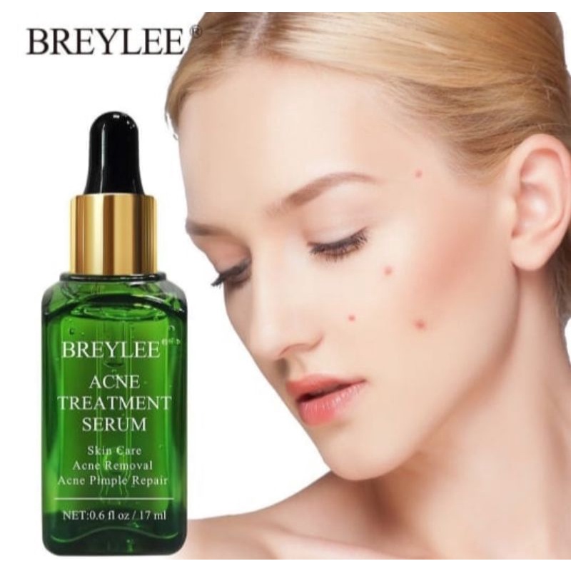 breylee acne treatment serum