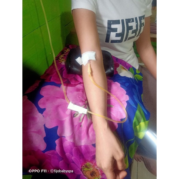 jasa infus whitening