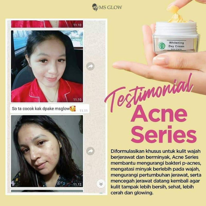 ms glow original paket acne