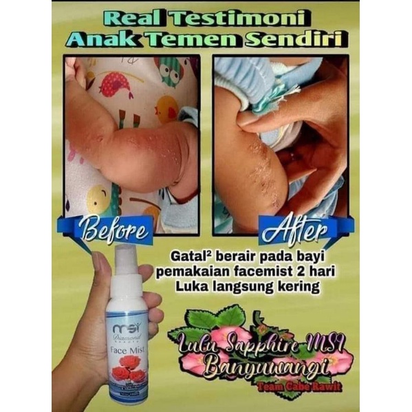 facemist
