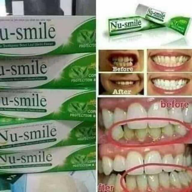 Nu smile Hwi