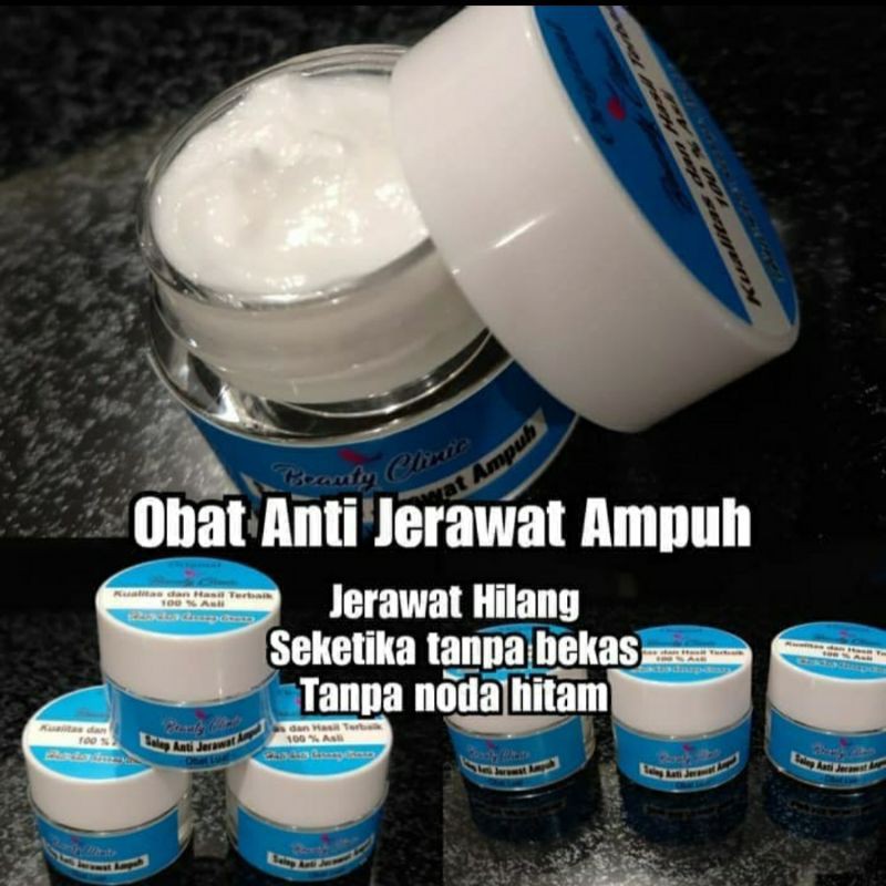 ACNE SOLUTION (Obat jerawat super ampuh)