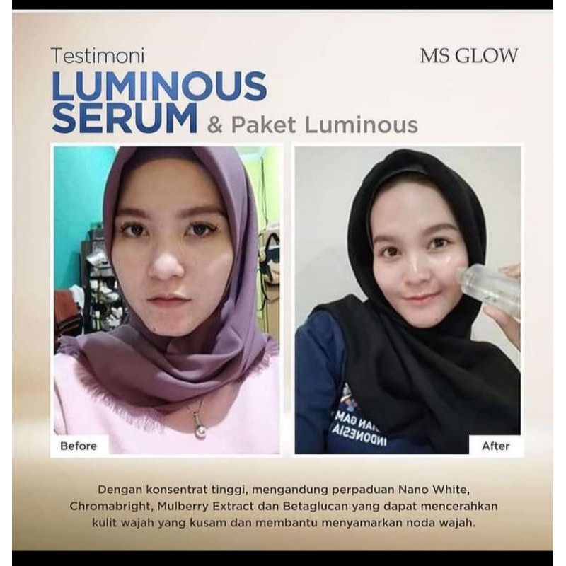 paket luminous msglow