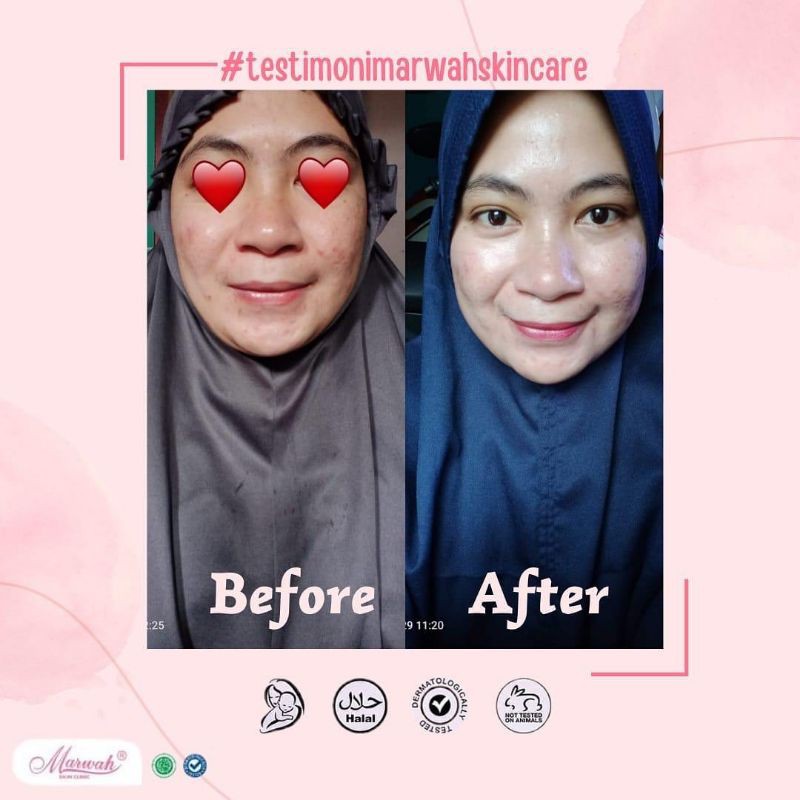 Marwah skincare
