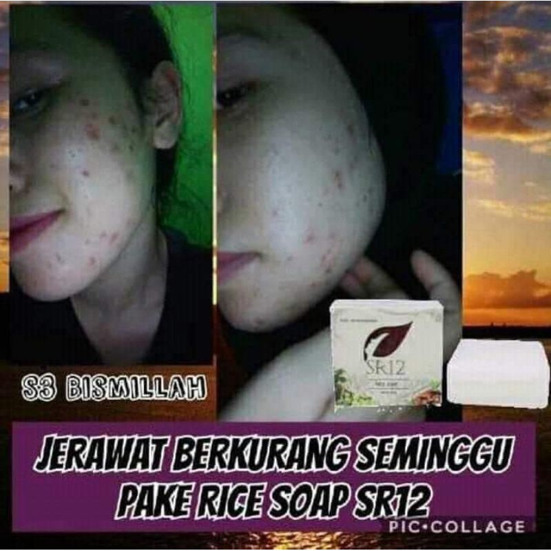 rice soap sr12