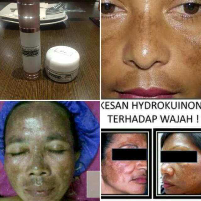 PAKET WOUND HEALING
