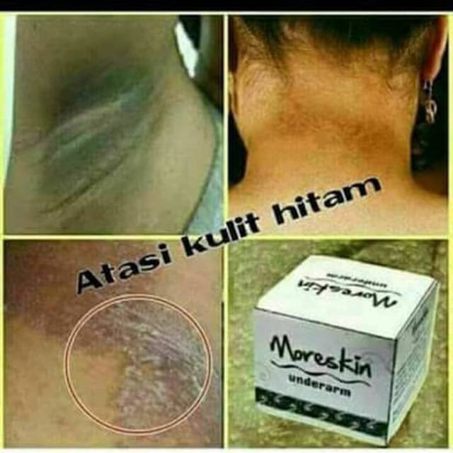 Moreskin underam/Underam