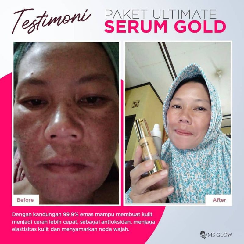 Whitening Gold Serum