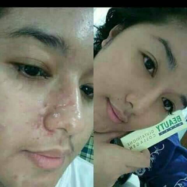 Natura beauty spray