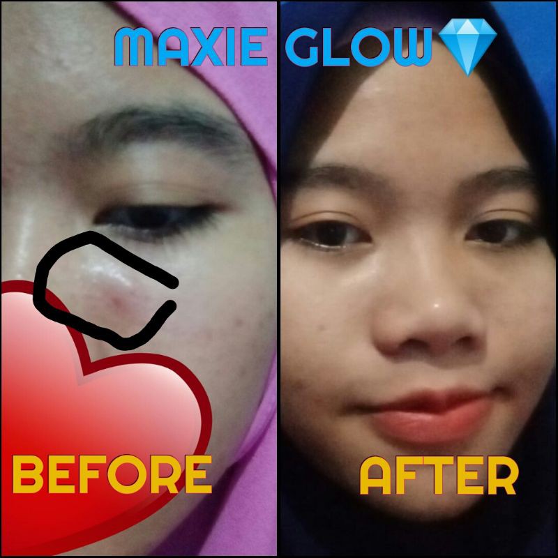maxie glow