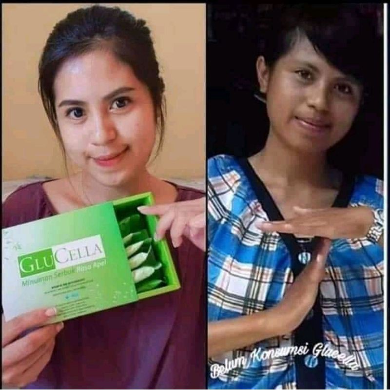 Glucella original HWI