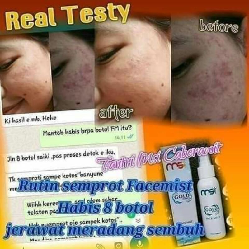 Face Mist