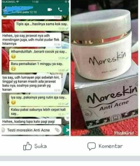 Moreskin acne nasa