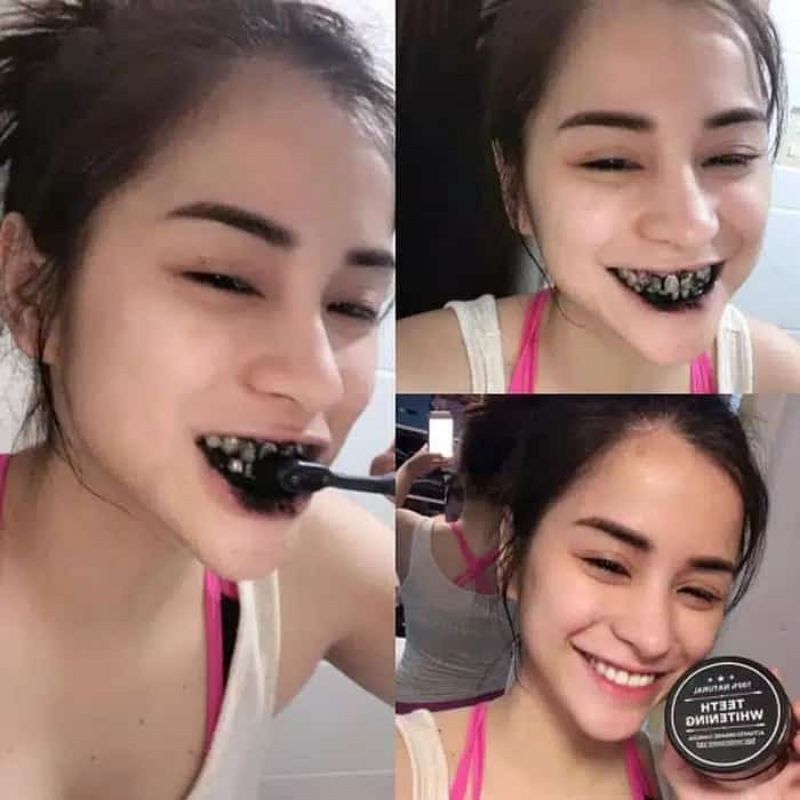 TEETH WHITENING