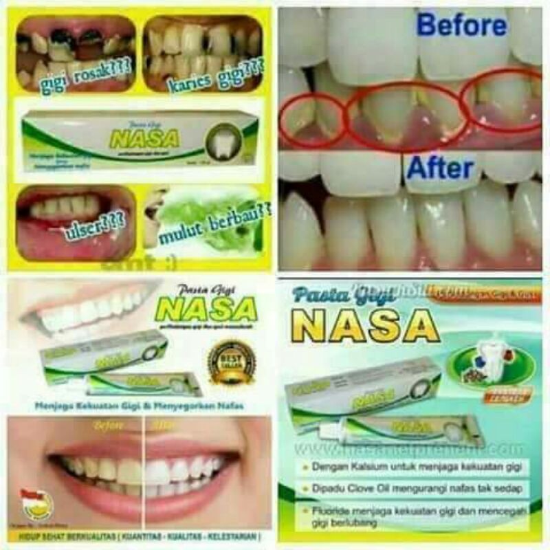 pasta gigi nasa/PGN