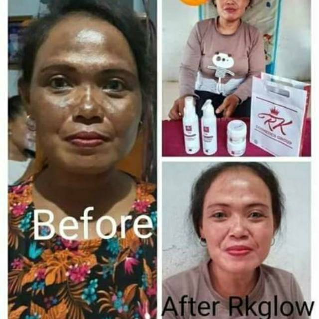 RK GLOW SKINCARE