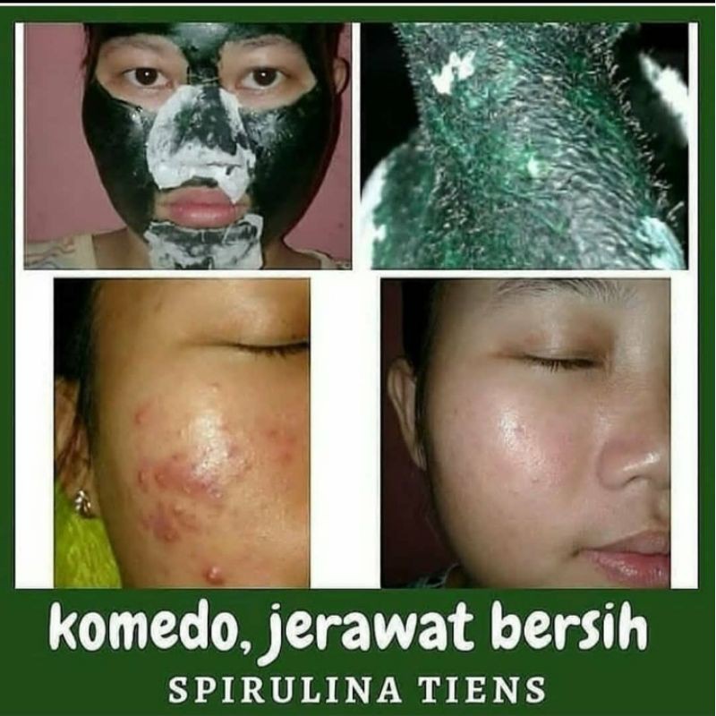 Spirulina tiens