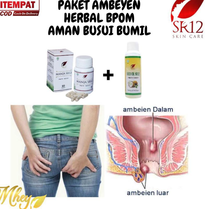 Paket ambeyen sr12 terampuh