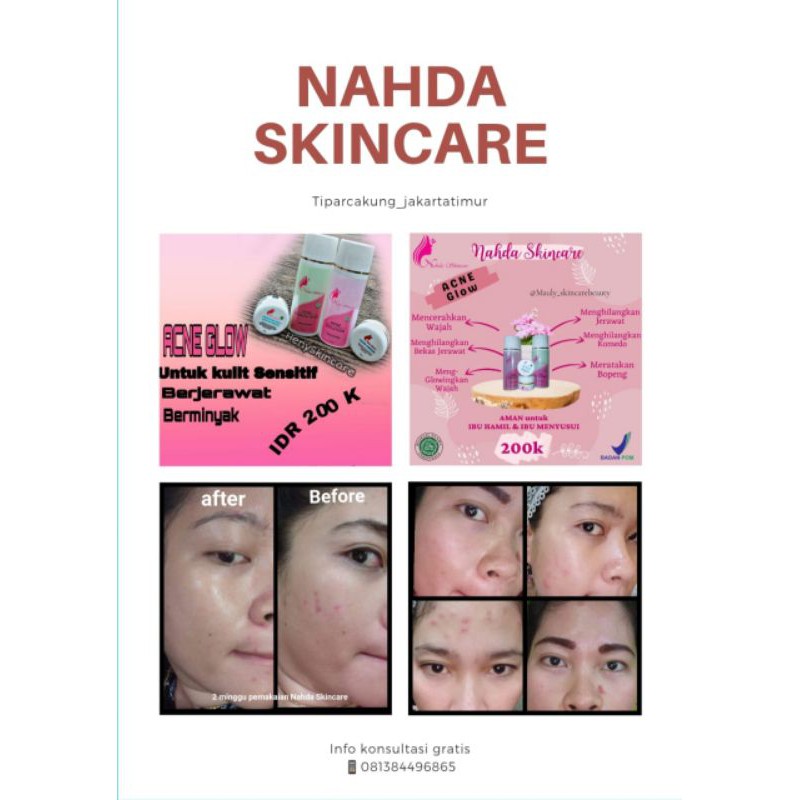 Nahdaskincare