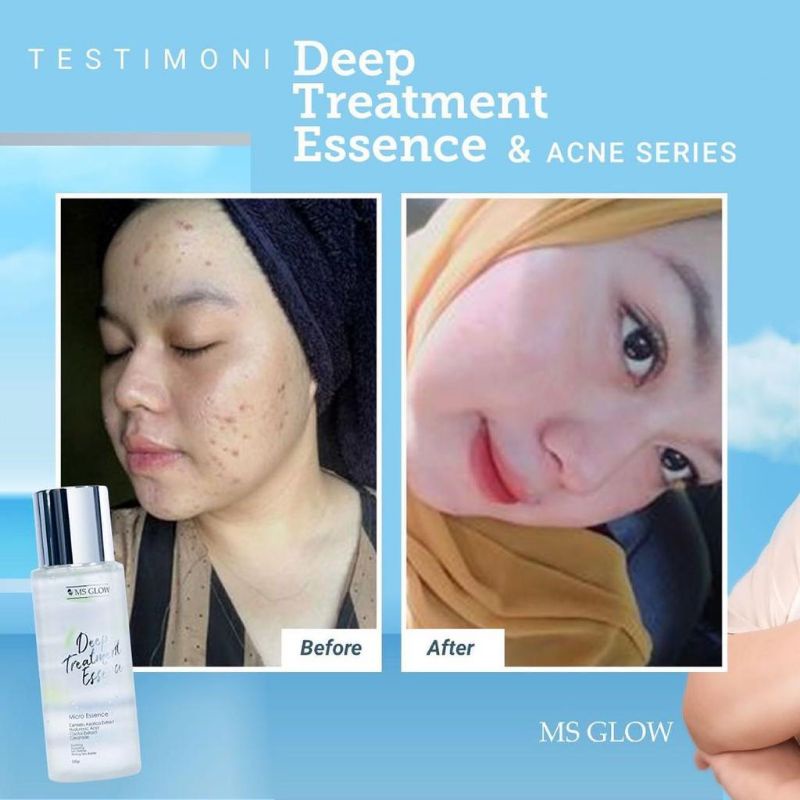 (MSGLOW) Deep treatment essence