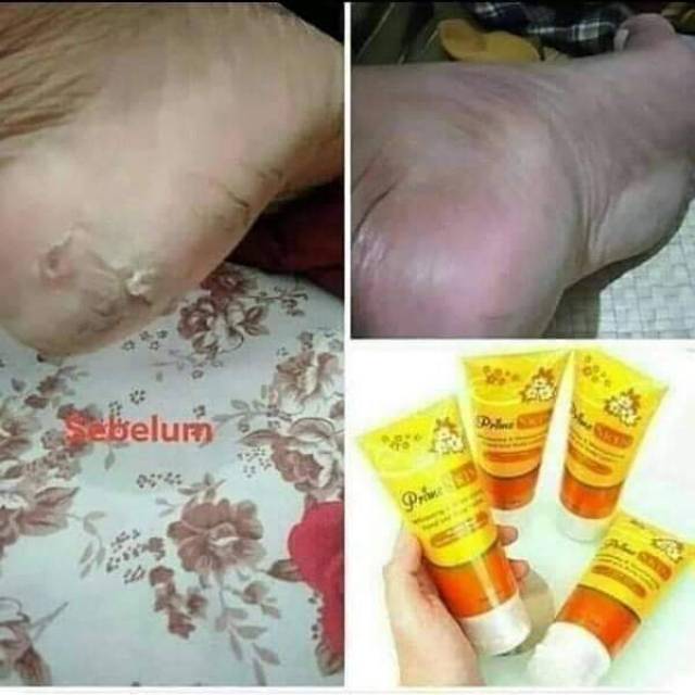 Pelembab kaki