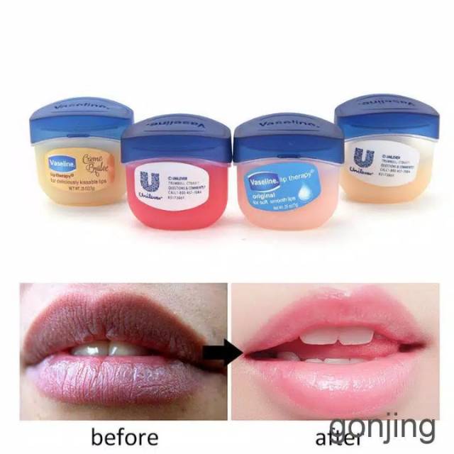 Vaseline