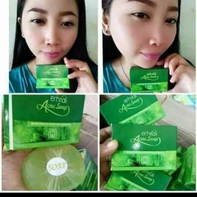 Ershali acne