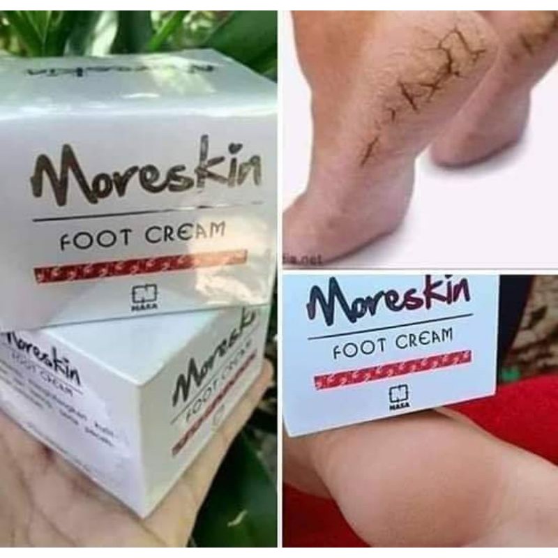 ATASIKAKIPECAH