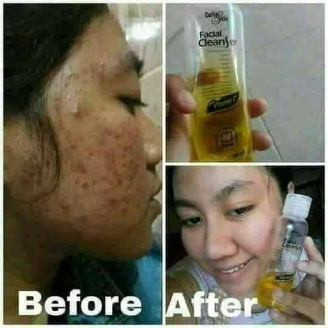 Facial Cleanser