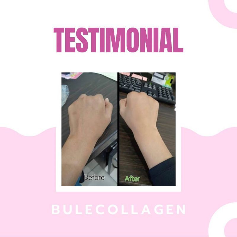 BULE COLLAGEN