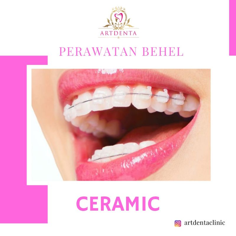 PEMASANGAN BEHEL CERAMIC