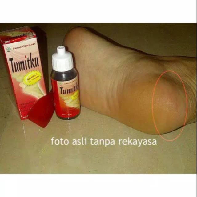 TUMITKU