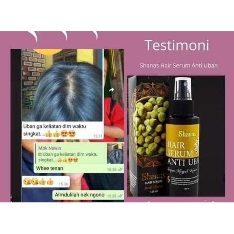 serum anti uban