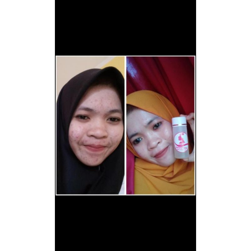 Toner Ds Skincare