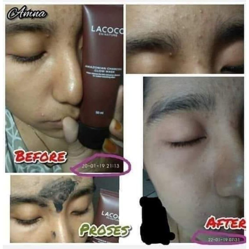 charcoal masklacococo