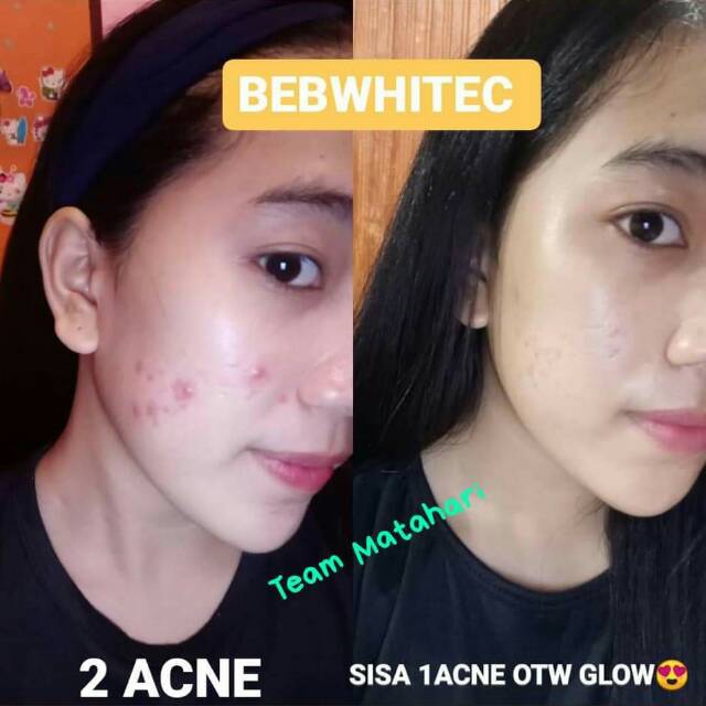 Beb white c