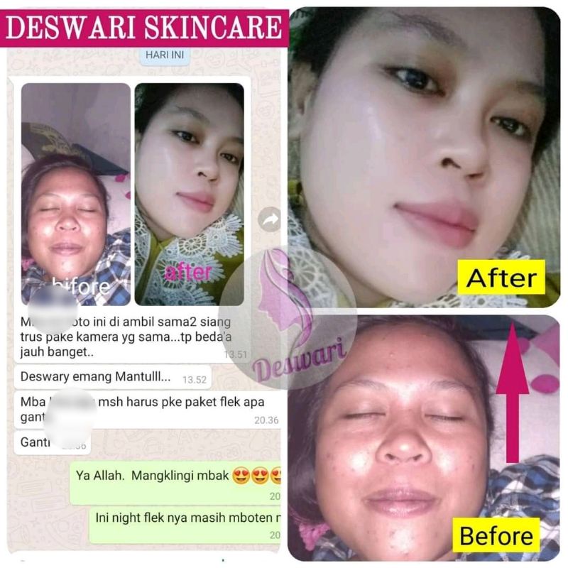 serum flek deswari