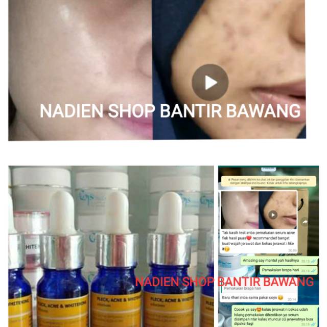 Serum acne flek plus whitening
